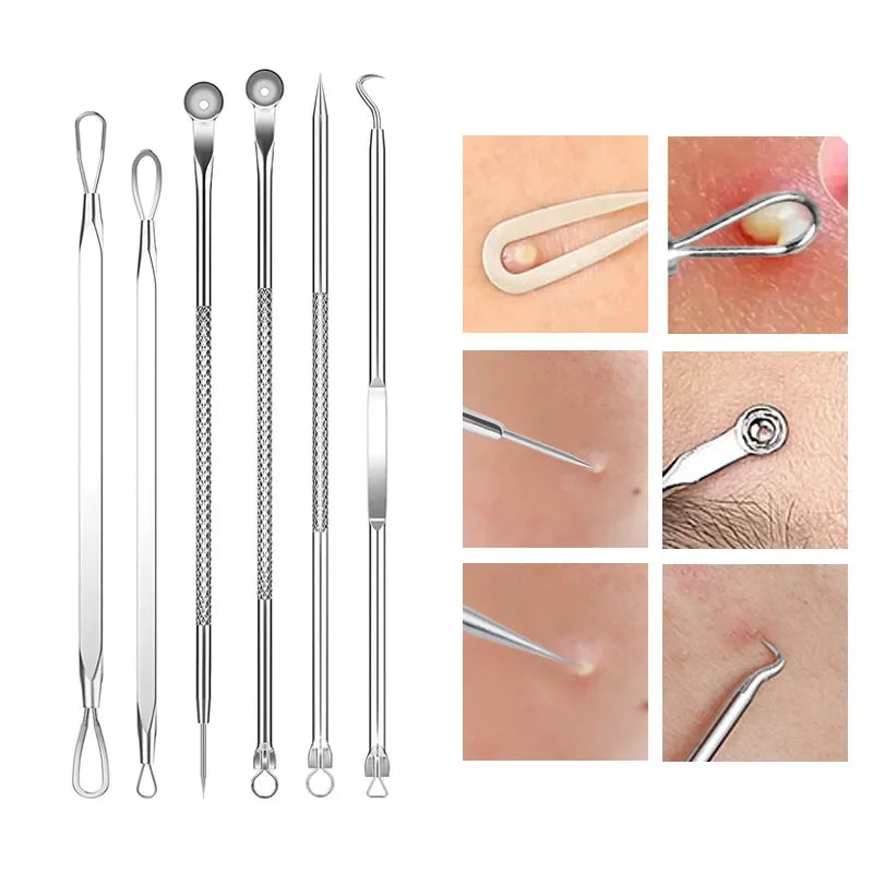 Ingrown Hair Tweezers And Blackhead Removal Needle Set