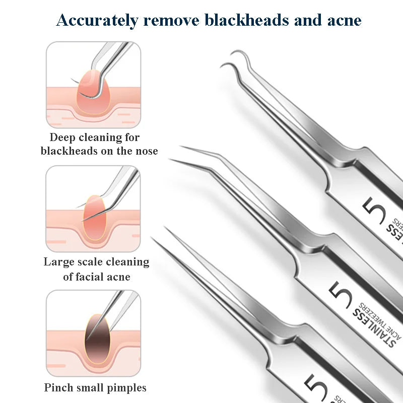 Ingrown Hair Tweezers And Blackhead Removal Needle Set